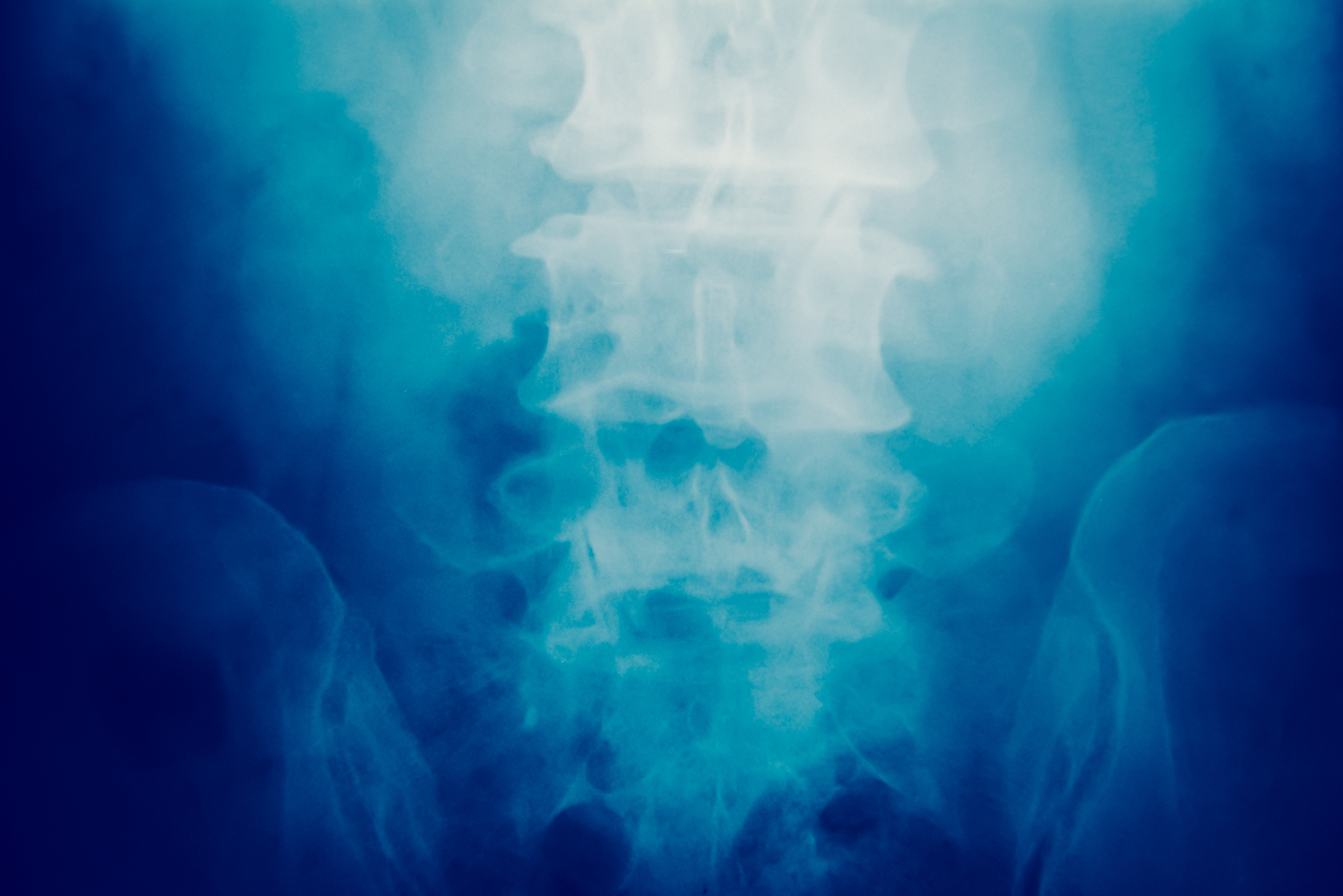 Spinal Injuries